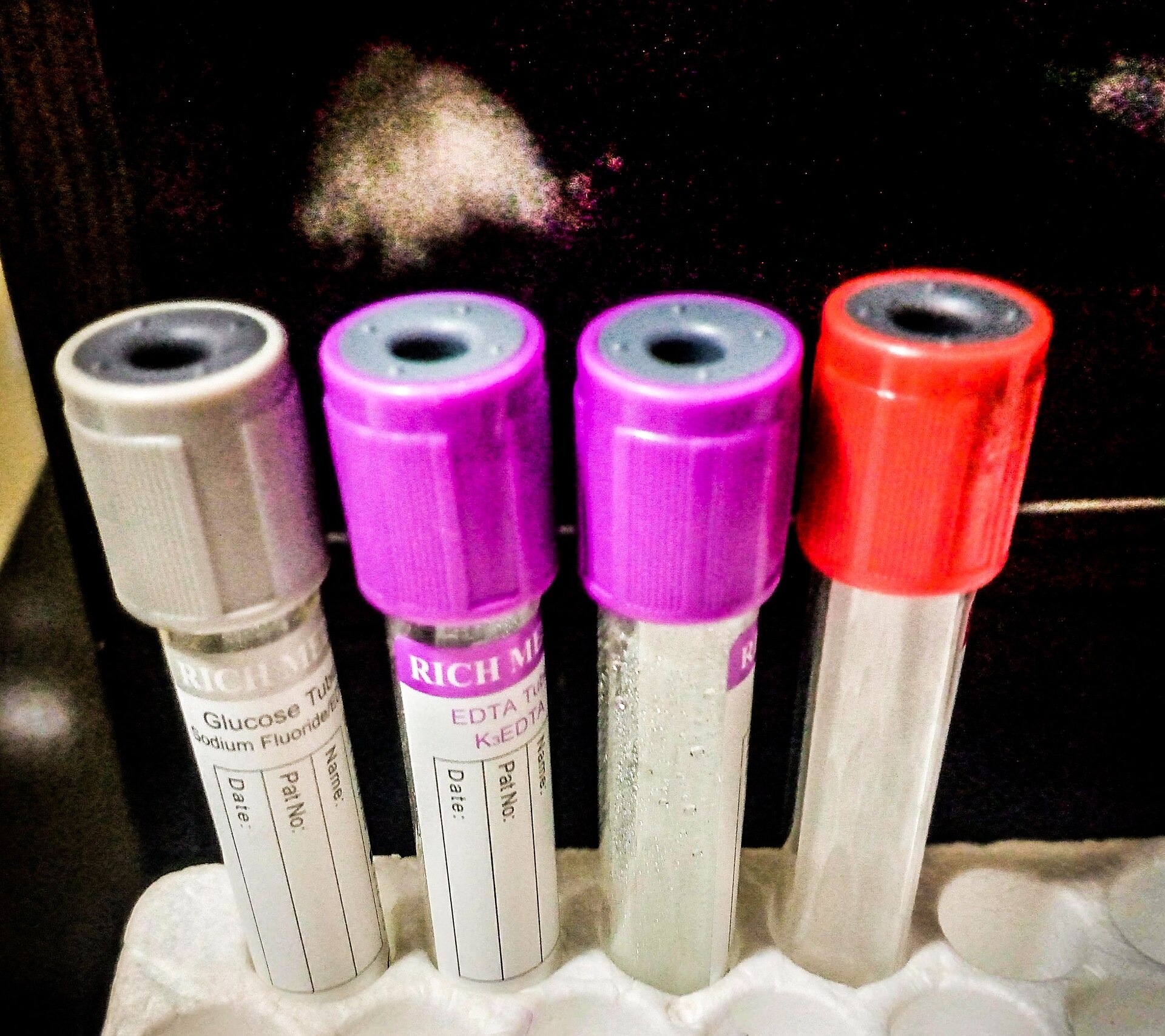 Reageerbuisjes met verschillende gekleurde doppen in een laboratoriumrek.