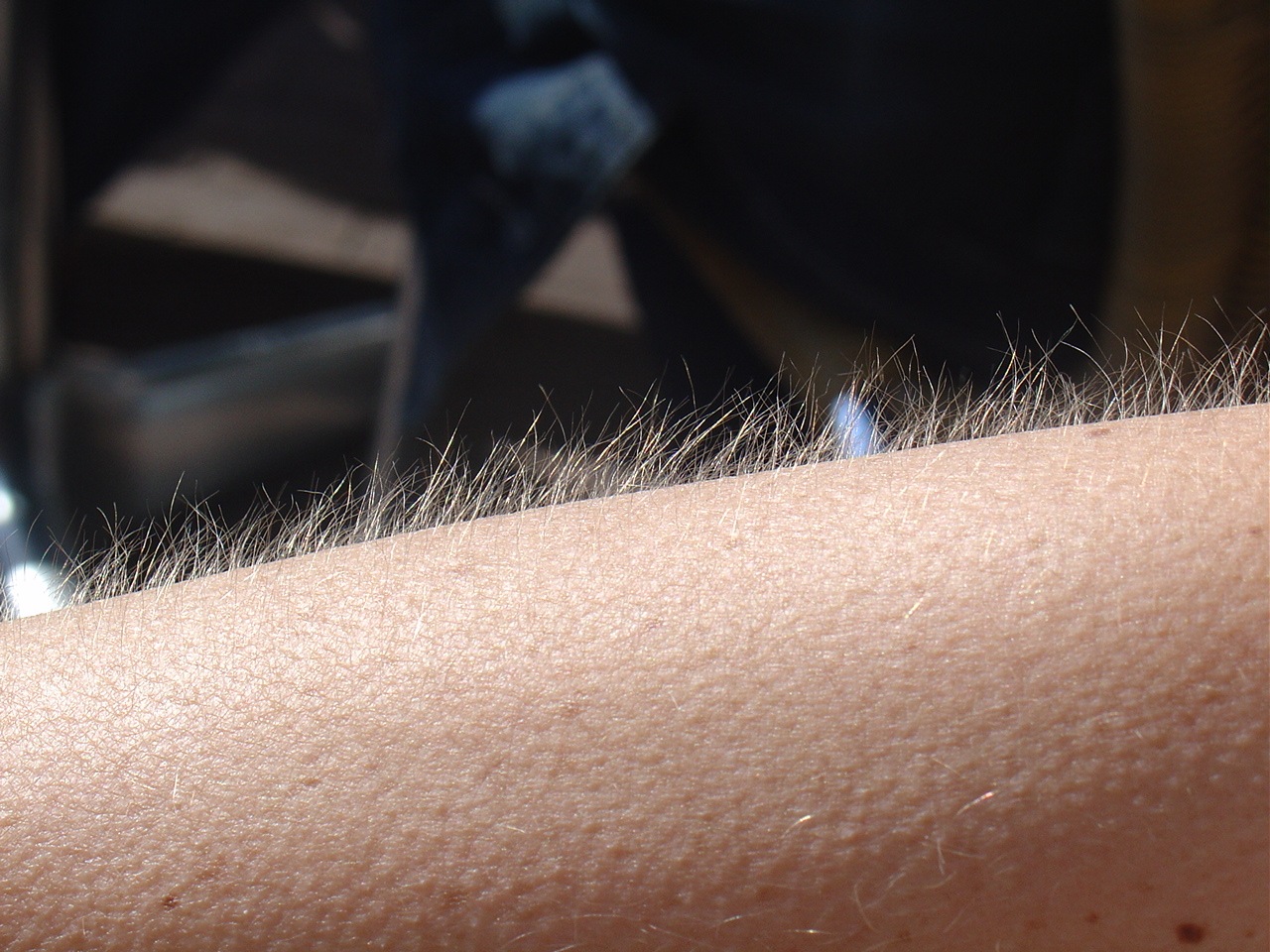 Kleine kippenvelbultjes en opstaande haartjes op een arm.